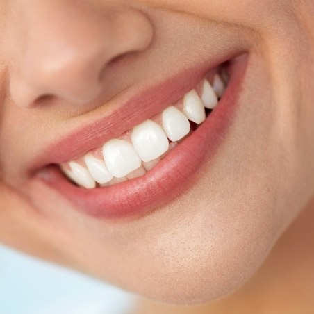 Close up of smile with flawless straight white teeth