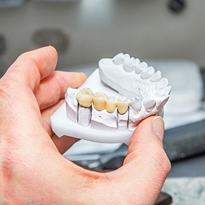 Technician in Grenada working on an implant prosthetic