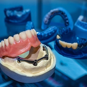 Example of implant denture at Kringle Dentistry