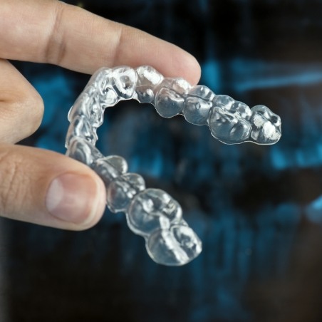 Hand holding a clear aligner in front of a dental x ray