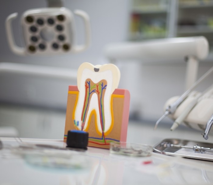 Model of decayed tooth that needs root canal treatment